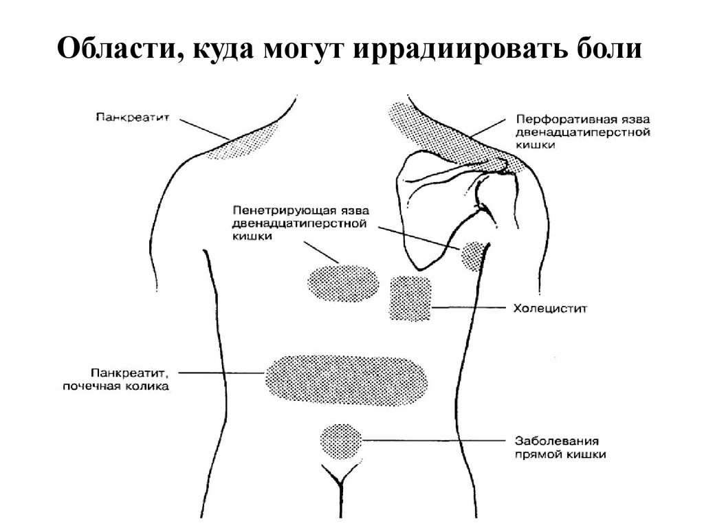 Система справа. Острый панкреатит локализация боли. Локализация боли поджелудочной железы. Иррадиация боли от поджелудочной железы. Острый панкреатит иррадиация боли.