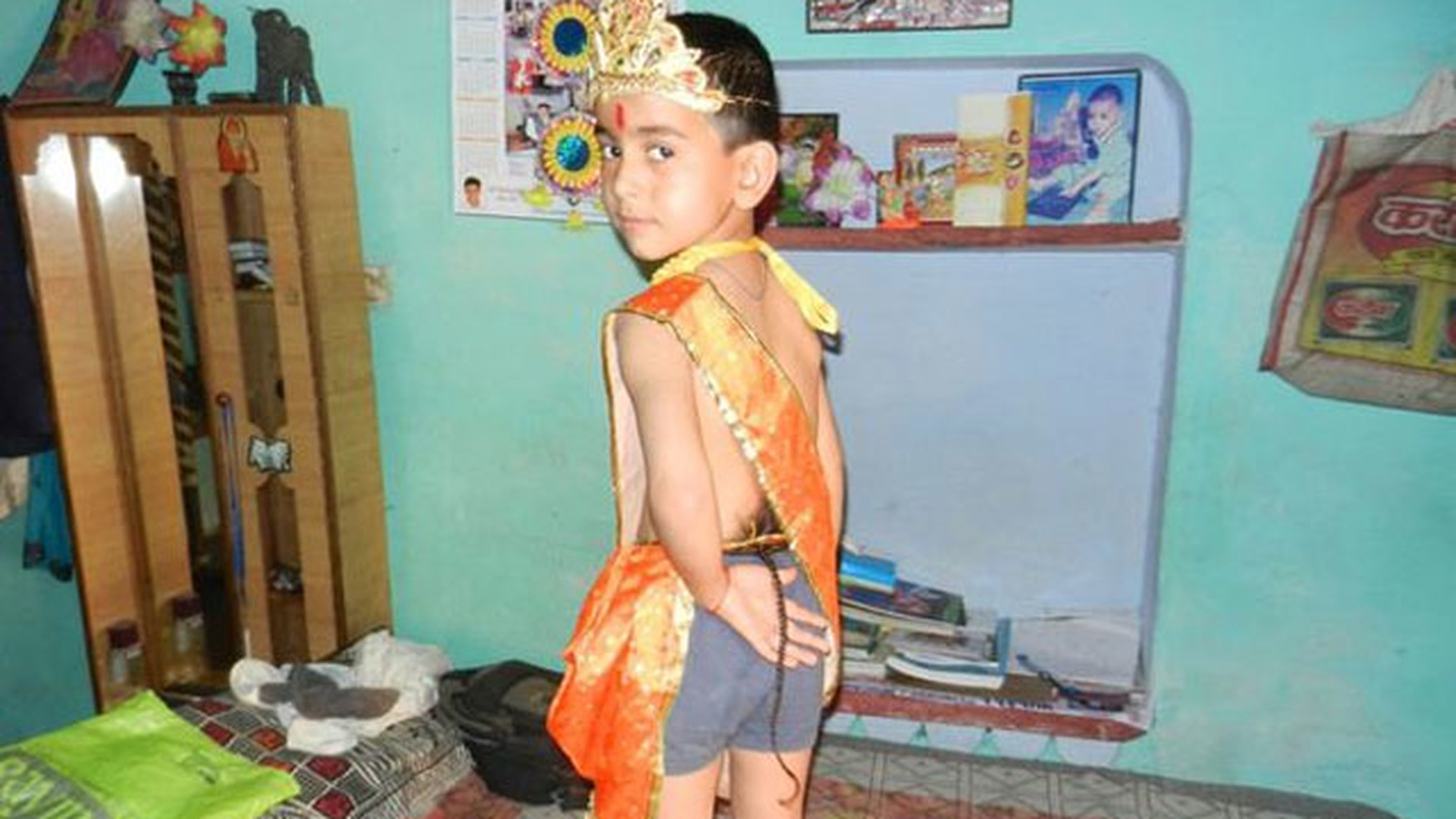 Люди с хвостами в реальной жизни. Мальчик с хвостом в Индии. Хвостатый мальчик в Индии.