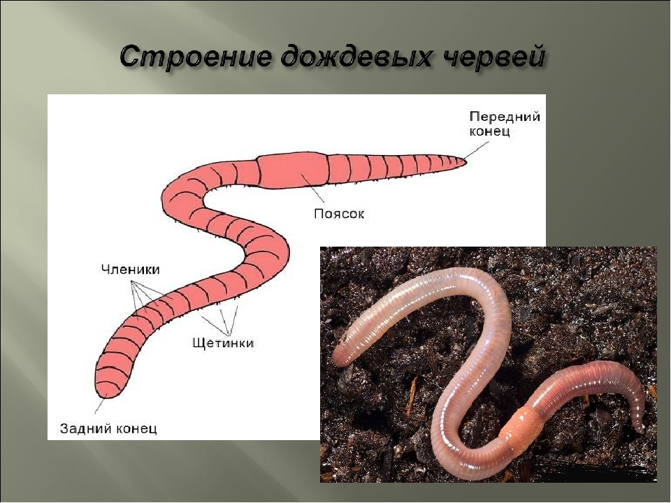 Дождевой червь это какой червь. Внутреннее строение дождевого червя. Дождевой червь под микроскопом строение. Строение дождевых червей.