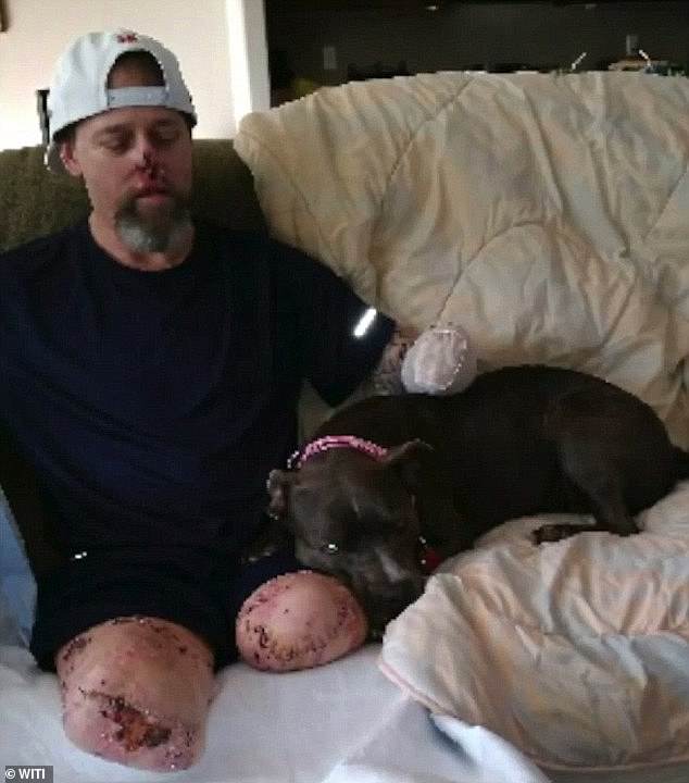 Manteufel was rushed to the hospital in June after experiencing flu-like symptoms and bruising on his arms and legs. Pictured: Manteufel reuniting with his dog, Ellie