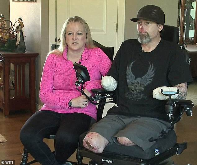 Doctors told him an infection had spread to all four of his limbs and, due to extensive tissue and muscle damage, they would be forced to amputate all of his limbs. Pictured: Manteufel, right, in his wheelchair with his wife Dawn