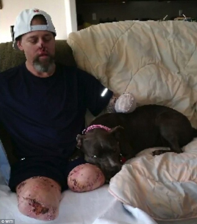  Tearful reunion: Greg Manteufel, 48, is finally home with his dog Ellie after a dog lick left him with life-threatening bacteria. Doctors had to amputate all his limbs to save him