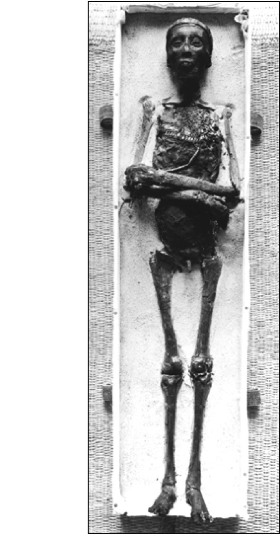 Один из первых снимков Тутанхамона, лишенного бальзамических покровов. Мужское достоинство - на месте. 