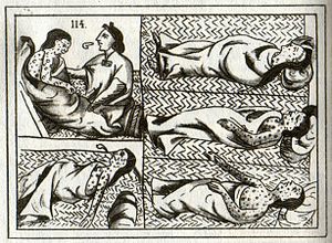 1857 гравюра больного Индеец ухаживают с помощью целителя коренного